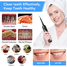 Load image into Gallery viewer, Home-use Electric Dental Clear Tools with LED Screen