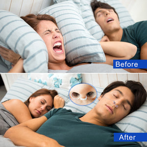 Ant Snoring Device